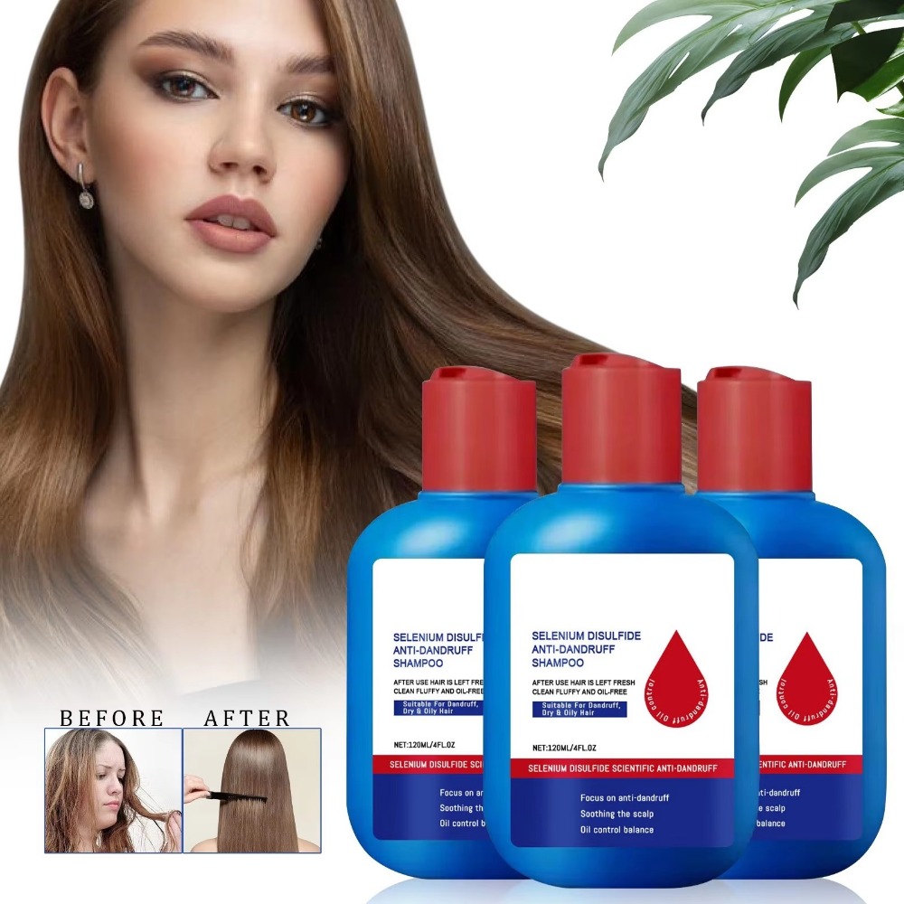 Nowy szampon Nipori 120ml Kont – Hair Care Dandruff recenzja i cena